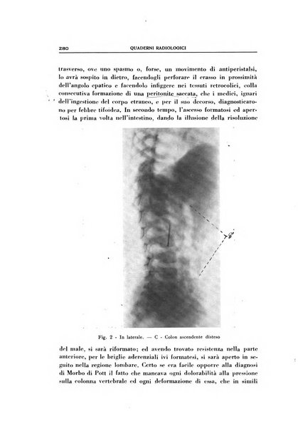 Quaderni radiologici rivista bimestrale di radiologia pratica