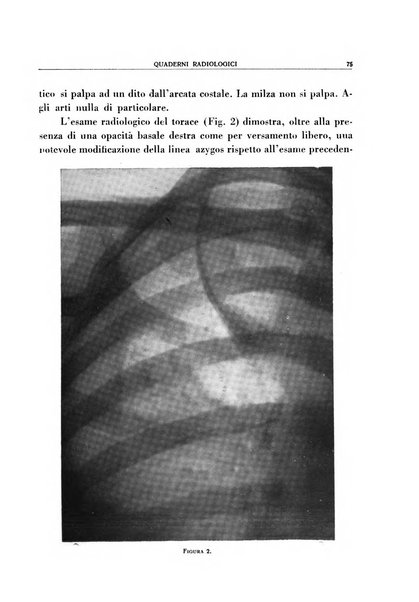 Quaderni radiologici rivista bimestrale di radiologia pratica