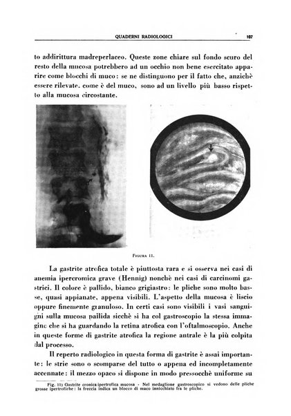 Quaderni radiologici rivista bimestrale di radiologia pratica