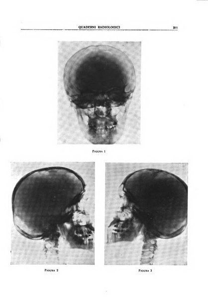 Quaderni radiologici rivista bimestrale di radiologia pratica