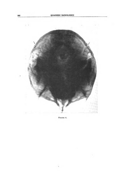 Quaderni radiologici rivista bimestrale di radiologia pratica