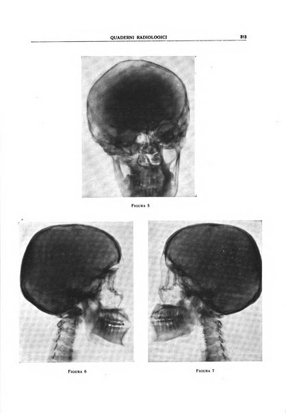 Quaderni radiologici rivista bimestrale di radiologia pratica