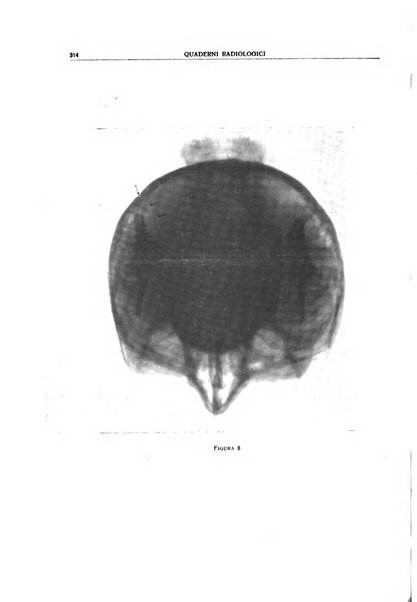 Quaderni radiologici rivista bimestrale di radiologia pratica