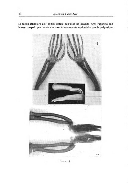 Quaderni radiologici rivista bimestrale di radiologia pratica