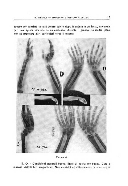 Quaderni radiologici rivista bimestrale di radiologia pratica