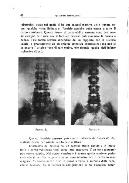 Quaderni radiologici rivista bimestrale di radiologia pratica