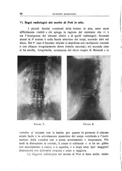 Quaderni radiologici rivista bimestrale di radiologia pratica