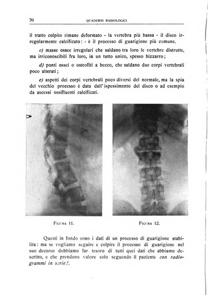 Quaderni radiologici rivista bimestrale di radiologia pratica