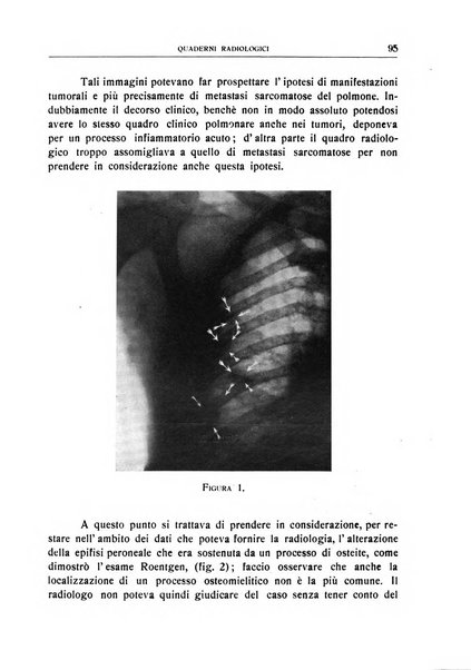 Quaderni radiologici rivista bimestrale di radiologia pratica