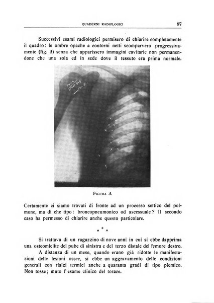 Quaderni radiologici rivista bimestrale di radiologia pratica