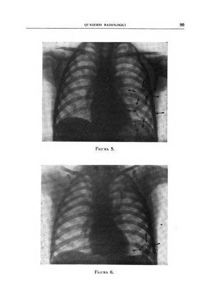 Quaderni radiologici rivista bimestrale di radiologia pratica