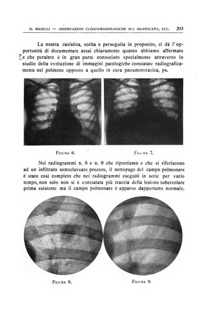 Quaderni radiologici rivista bimestrale di radiologia pratica