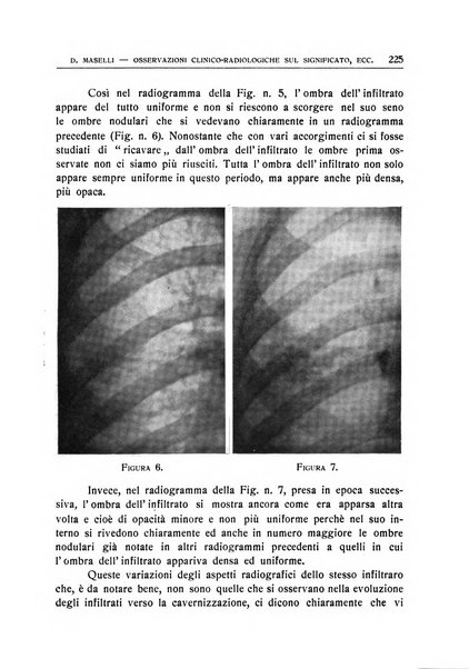 Quaderni radiologici rivista bimestrale di radiologia pratica