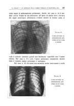 giornale/TO00216400/1936/unico/00000317