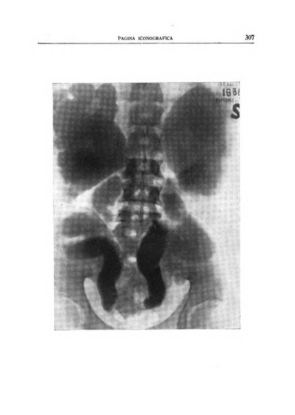 Quaderni radiologici rivista bimestrale di radiologia pratica