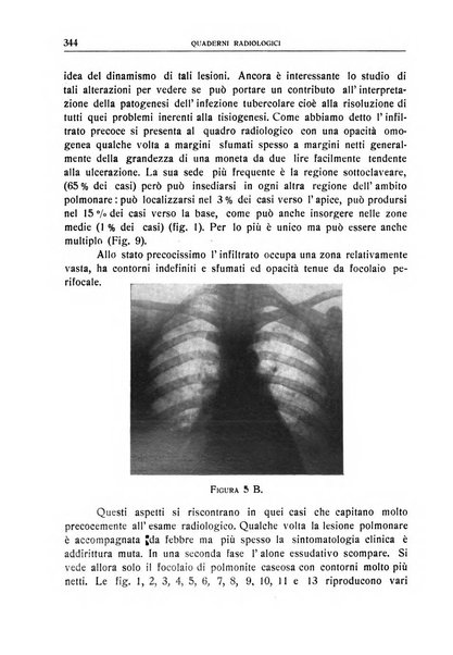 Quaderni radiologici rivista bimestrale di radiologia pratica