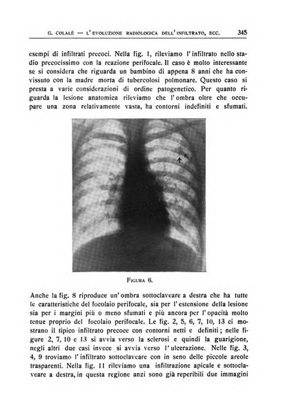 Quaderni radiologici rivista bimestrale di radiologia pratica