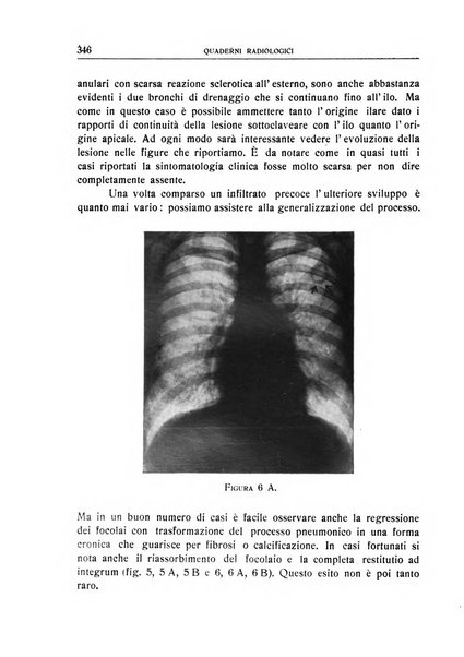 Quaderni radiologici rivista bimestrale di radiologia pratica