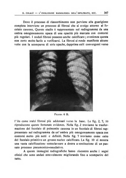 Quaderni radiologici rivista bimestrale di radiologia pratica