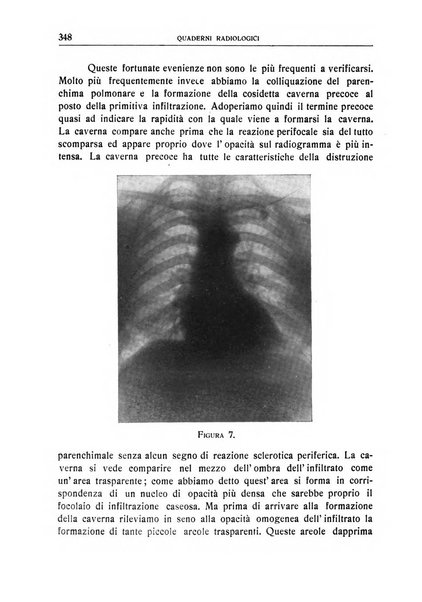 Quaderni radiologici rivista bimestrale di radiologia pratica