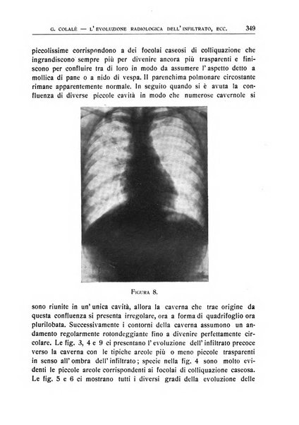 Quaderni radiologici rivista bimestrale di radiologia pratica