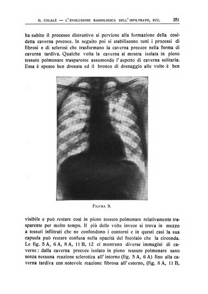 Quaderni radiologici rivista bimestrale di radiologia pratica