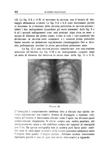 Quaderni radiologici rivista bimestrale di radiologia pratica