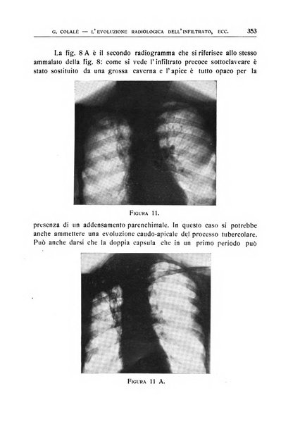 Quaderni radiologici rivista bimestrale di radiologia pratica