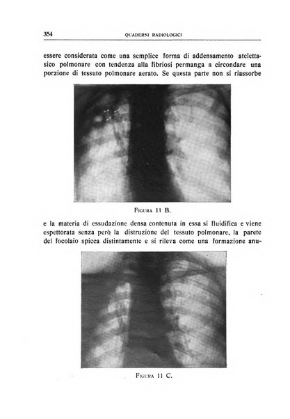 Quaderni radiologici rivista bimestrale di radiologia pratica