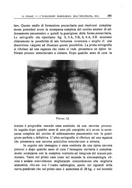 Quaderni radiologici rivista bimestrale di radiologia pratica