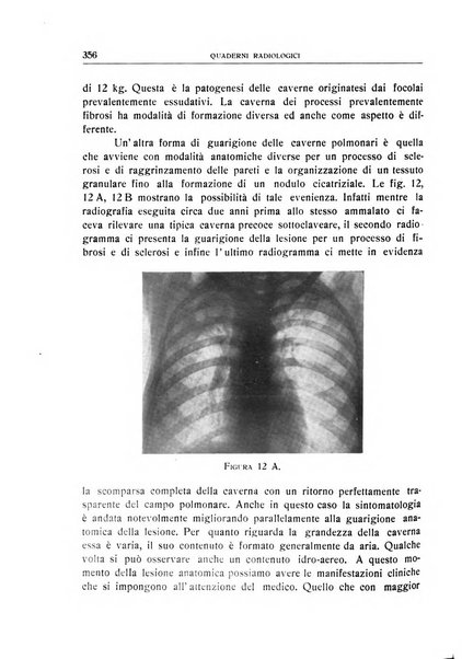 Quaderni radiologici rivista bimestrale di radiologia pratica