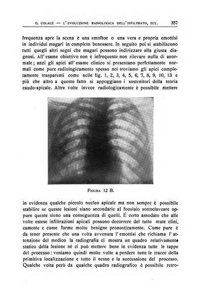 Quaderni radiologici rivista bimestrale di radiologia pratica