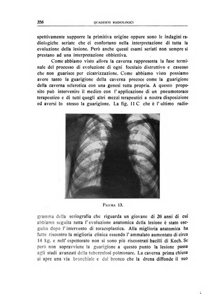 Quaderni radiologici rivista bimestrale di radiologia pratica