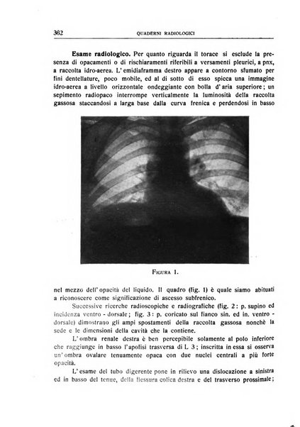 Quaderni radiologici rivista bimestrale di radiologia pratica