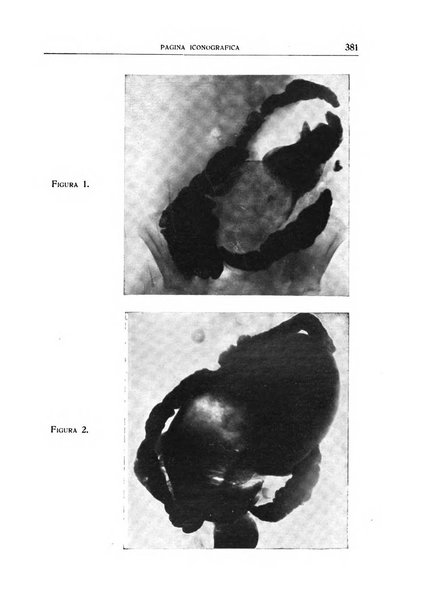 Quaderni radiologici rivista bimestrale di radiologia pratica