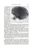 giornale/TO00216443/1932/unico/00000217