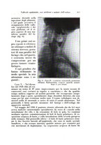 giornale/TO00216443/1932/unico/00000863