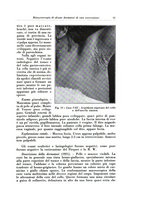 giornale/TO00216443/1933/unico/00000069