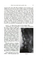 giornale/TO00216443/1933/unico/00000095