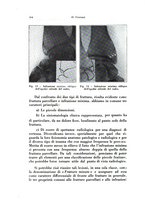 giornale/TO00216443/1933/unico/00000614