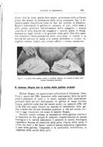 giornale/TO00216864/1941/unico/00000343