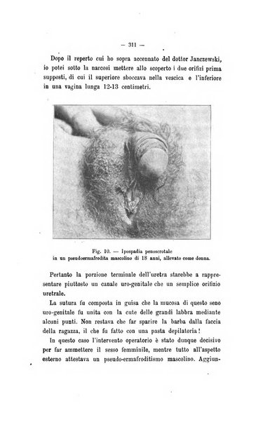 Archivio di psichiatria, neuropatologia, antropologia criminale e medicina legale