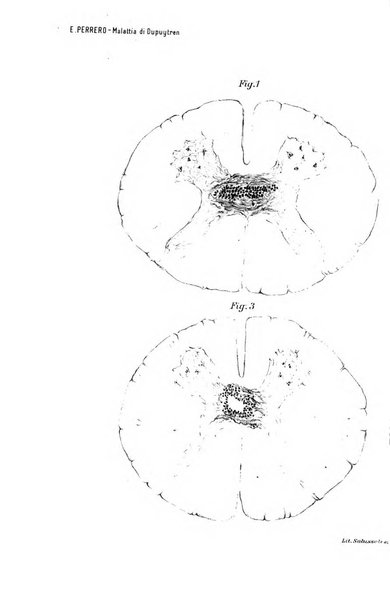 Archivio di psichiatria, neuropatologia, antropologia criminale e medicina legale