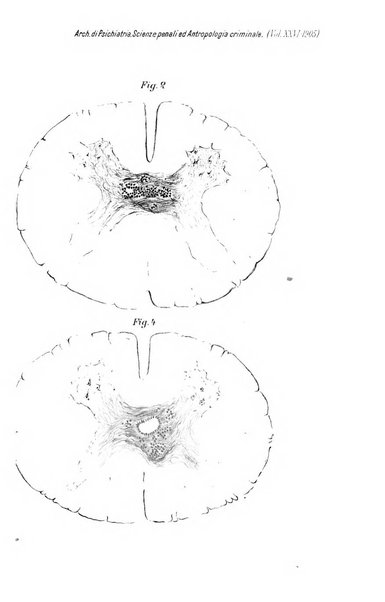 Archivio di psichiatria, neuropatologia, antropologia criminale e medicina legale