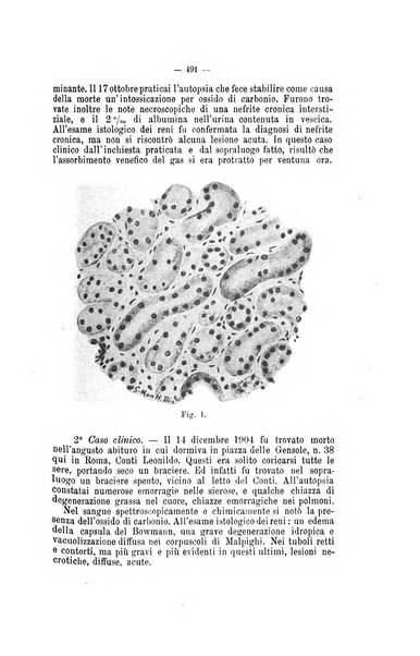 Archivio di psichiatria, neuropatologia, antropologia criminale e medicina legale