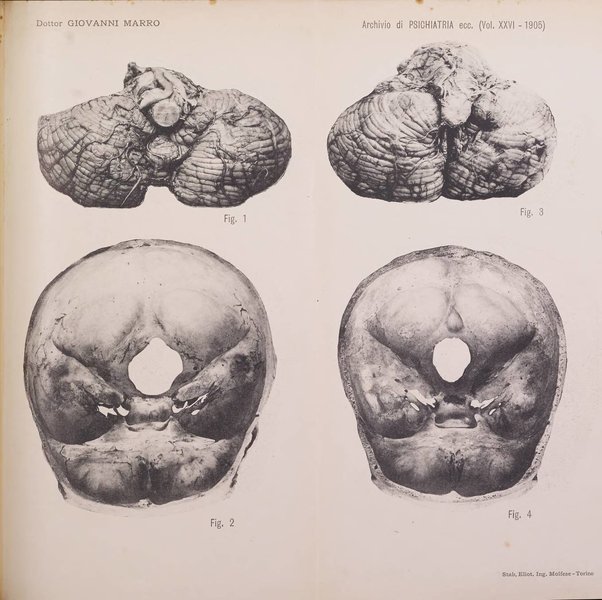 Archivio di psichiatria, neuropatologia, antropologia criminale e medicina legale