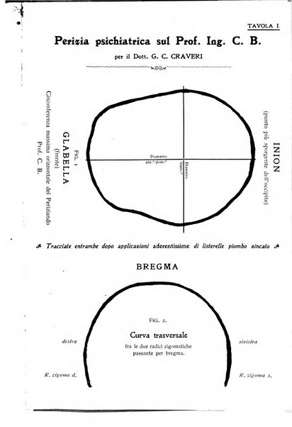 Archivio di psichiatria, neuropatologia, antropologia criminale e medicina legale