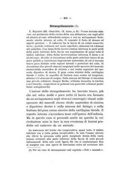 Archivio di psichiatria, neuropatologia, antropologia criminale e medicina legale