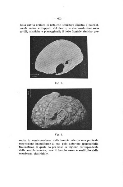 Archivio di psichiatria, neuropatologia, antropologia criminale e medicina legale