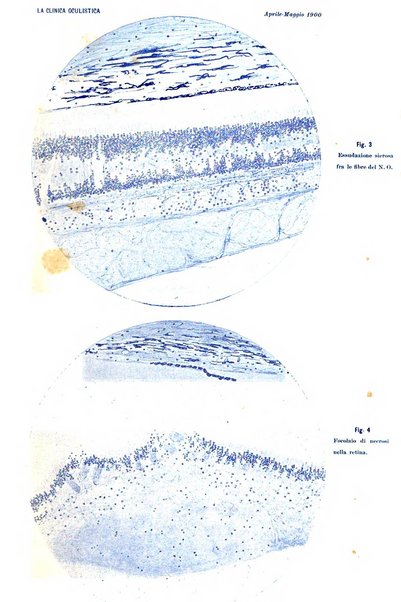 La Clinica oculistica periodico mensile per i medici pratici